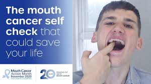 how to check yourself for mouth cancer