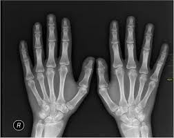 Maybe you would like to learn more about one of these? How Much Does An X Ray Cost Near Me From 45