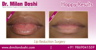 lip reduction surgery cost archives
