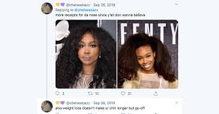 sza before surgery see the singer s