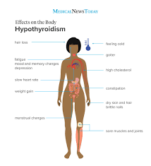 Hypothyroidism Symptoms 12 Signs To Look Out For