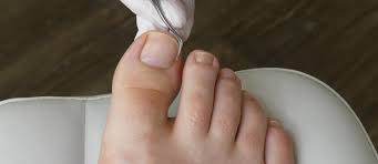 painless ingrown toenail treatment