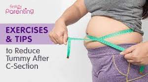 how to reduce belly fat after c section