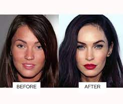 celebrity plastic surgery 31 before