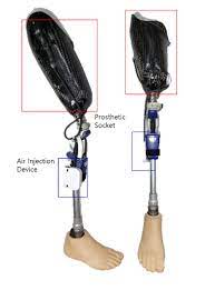 ai based prosthetic socket developed to