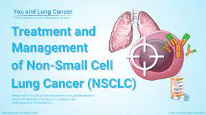 small cell lung cancer nsclc