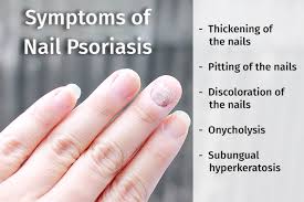 nail psoriasis symptoms diagnosis