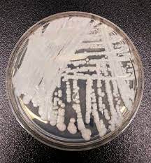 CDC: Deadly Candida auris fungus spreading quickly through health care  sites : NPR