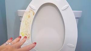 Yellow Stains From The Toilet Seat And Lid