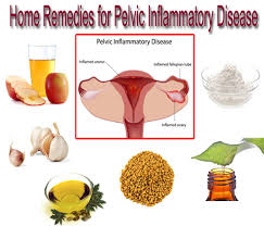 pelvic inflammatory disease causes