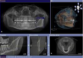 3d imaging evergreen dental