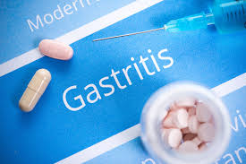 Gastritis Diet Foods To Eat And Avoid Dietary Plan And