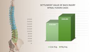 average settlement for spinal fusion