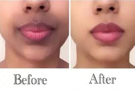 how to lighten dark upper lip 10 home