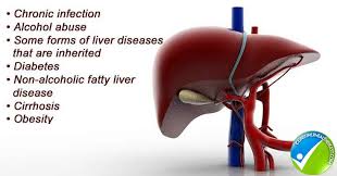 Can liver cancer be found early? Liver Cancer Overview Types Symptoms Causes Treatment