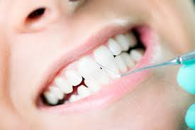 types of teeth cleaning quadrant