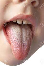 彼女を示している女の子の舌、マクロの写真素材・画像素材 Image 24888234