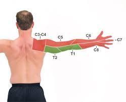 Cervical Dermatome Map Physical Therapy Massage Therapy