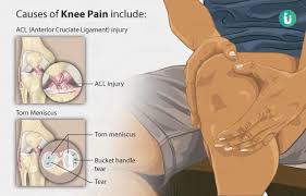 knee pain symptoms causes treatment
