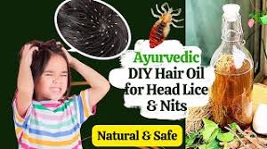 ayurvedic homemade hair oil for