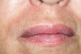 swollen lips stock image c023 4297