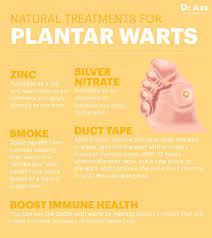 stop plantar warts in their tracks with