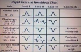 Rapid Axis Chart Hemiblock Chart Chart Cardiology Diagram