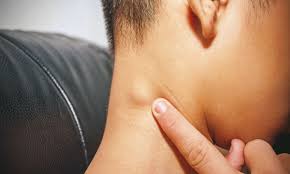swollen lymph nodes symptoms causes