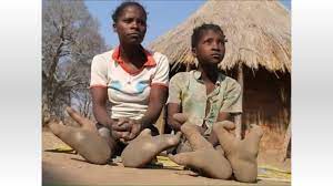 ダチョウの足を持つジンバブエの「ヴァドマ族」とは？ 歩行困難でも木登りは高速!?（2023年8月23日）｜BIGLOBEニュース