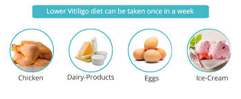 Vitiligo Diet Restrictions Chart Of Food Items For