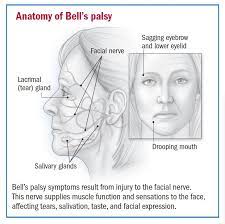 bell s palsy overview harvard health