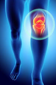 depuy attune knee replacement defects