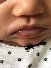baby s lips half white babycenter
