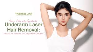 laser underarm hair removal