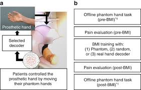 brain plasticity controls pain