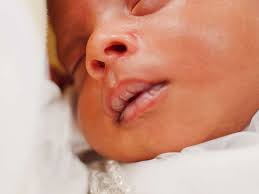 newborn chapped lips treatment and causes