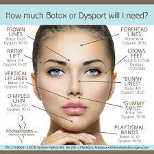 Check spelling or type a new query. Why Don T I Love My Botox Dysport Results Ay Magazine