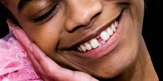 Other solutions for gaps between teeth include braces, veneers, implants, and even surgery. Why I Don T Mind The Gap Between My Front Teeth