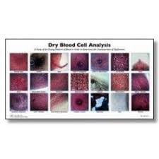 Dried Blood Cell Analysis Chart Blood Cells Chart Blood