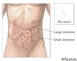 Pinworms Information Mount Sinai