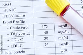 normal lipid profile test result with