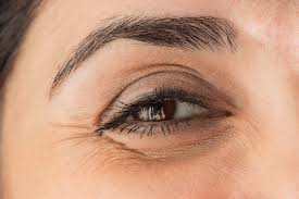 wrinkled eyelids how to get rid of