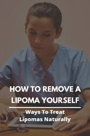 ways to treat lipomas naturally