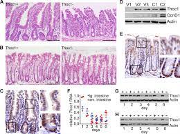 This article is concerned with the microbes residing in one particular niche: Thoc1 Gene Deletion Affects The Histology Of The Small Intestine But Download Scientific Diagram