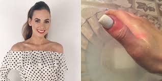 are gel manicures safe uv exposure