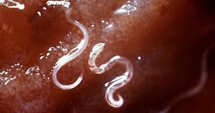 worms phyla platyhelmintes nematoda