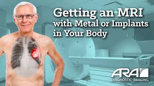getting an mri with metal or implants