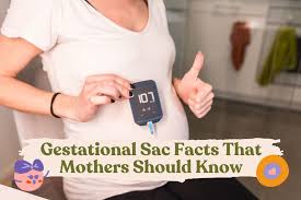 facts about gestational sac that