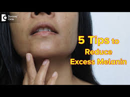 reduce melanin in body permanently dr