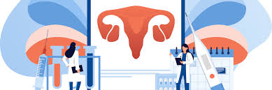 In cases of ovarian cancer, ultrasound usually reveals complex cysts on one or both ovaries, multiple solid masses, nodule on the bowel or excess pelvic and/or abdominal fluid. Ovarian Cancer Population Screening Study Signals Need For Additional Biomarkers Cancer World Magazine